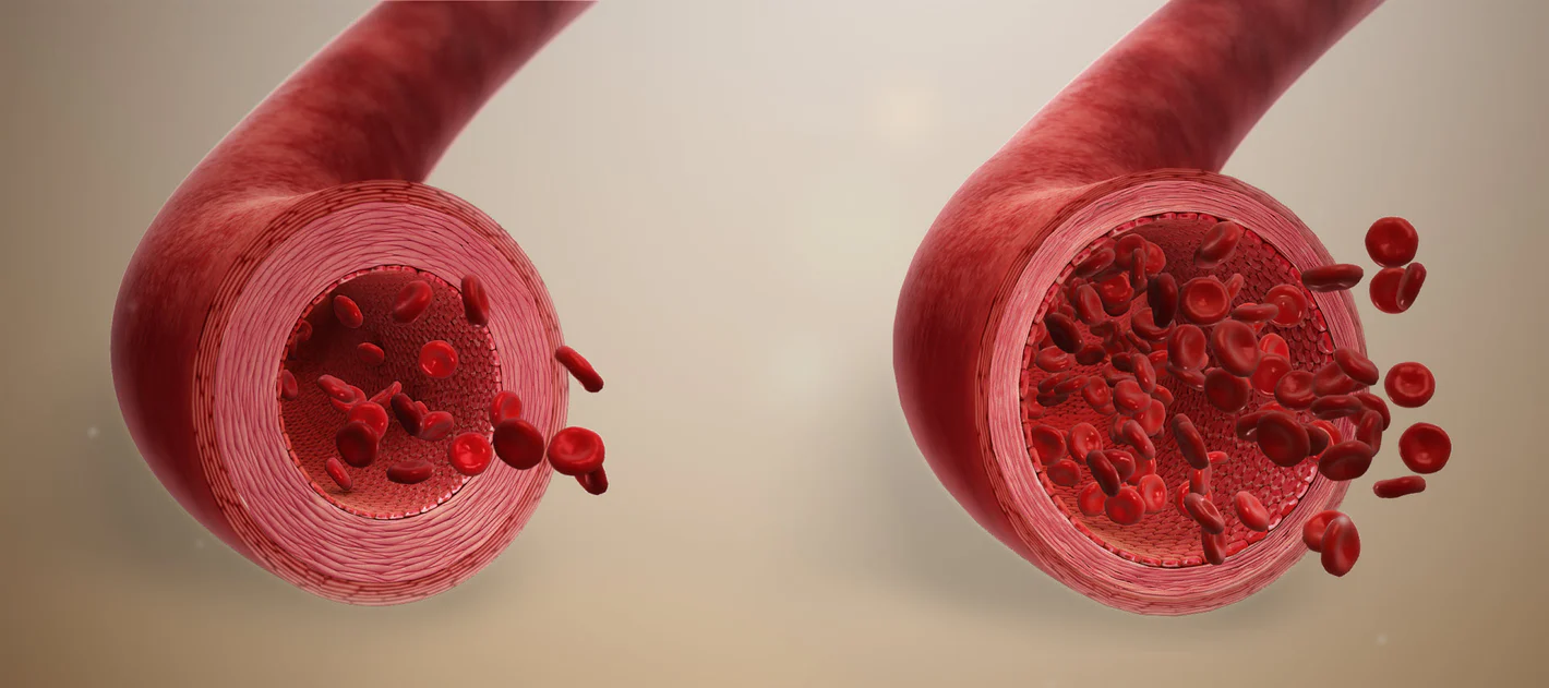 Vasodilation