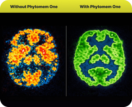 brain-before-after